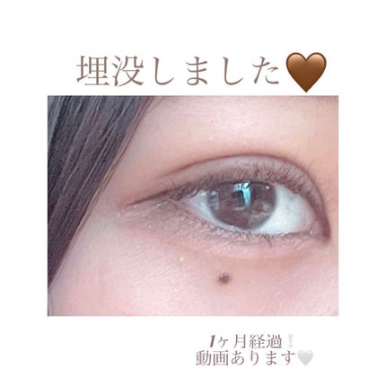 ððððð on LIPS ãããã«ã¡ã¯ãððððã§ãð€æšæ¥ã§æŽåœ¢ãããŠãã1ã¶æãçµã£ãã®..ãïŒ1æç®ïŒ