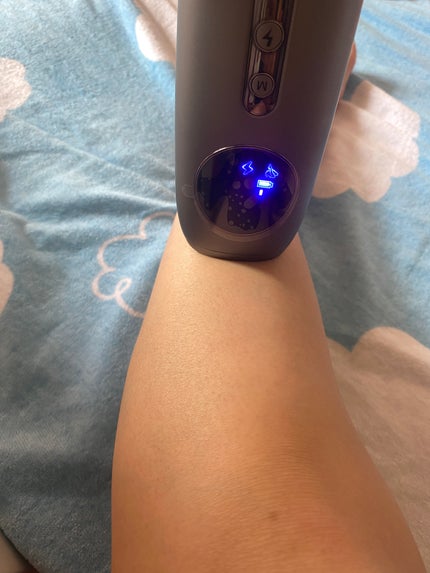 コードレス脱毛器/Noend/家庭用脱毛器を使ったクチコミ(4枚目)