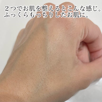 ヘパトリート 薬用保湿化粧水/ゼトックスタイル/化粧水を使ったクチコミ(4枚目)