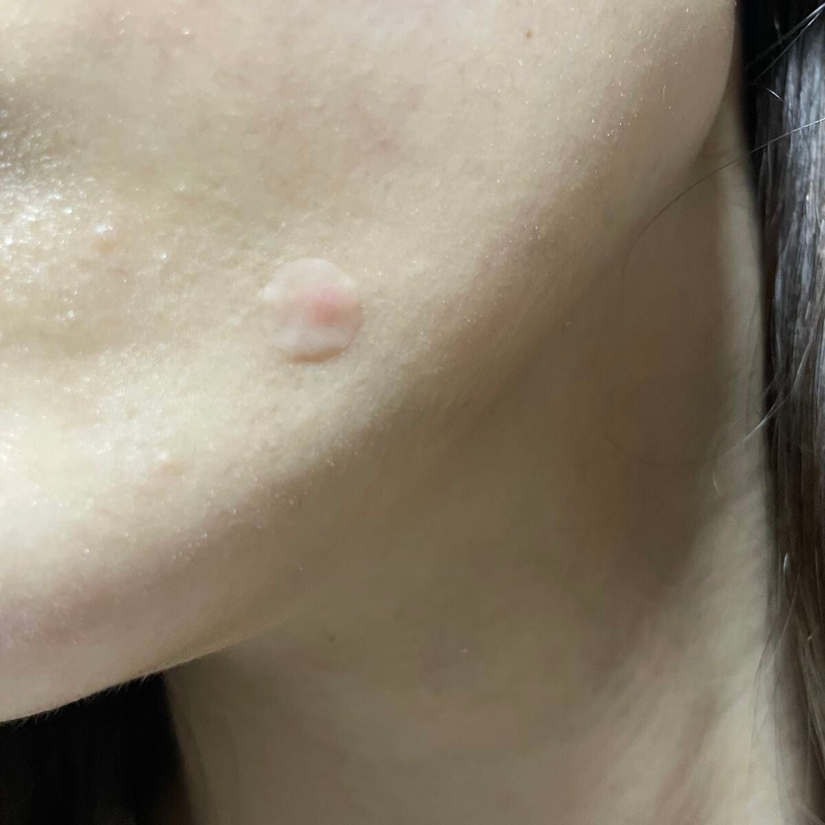 ごめんね素肌 キニシナイパッチ/クリアターン/シートマスク・パックを使ったクチコミ(4枚目)