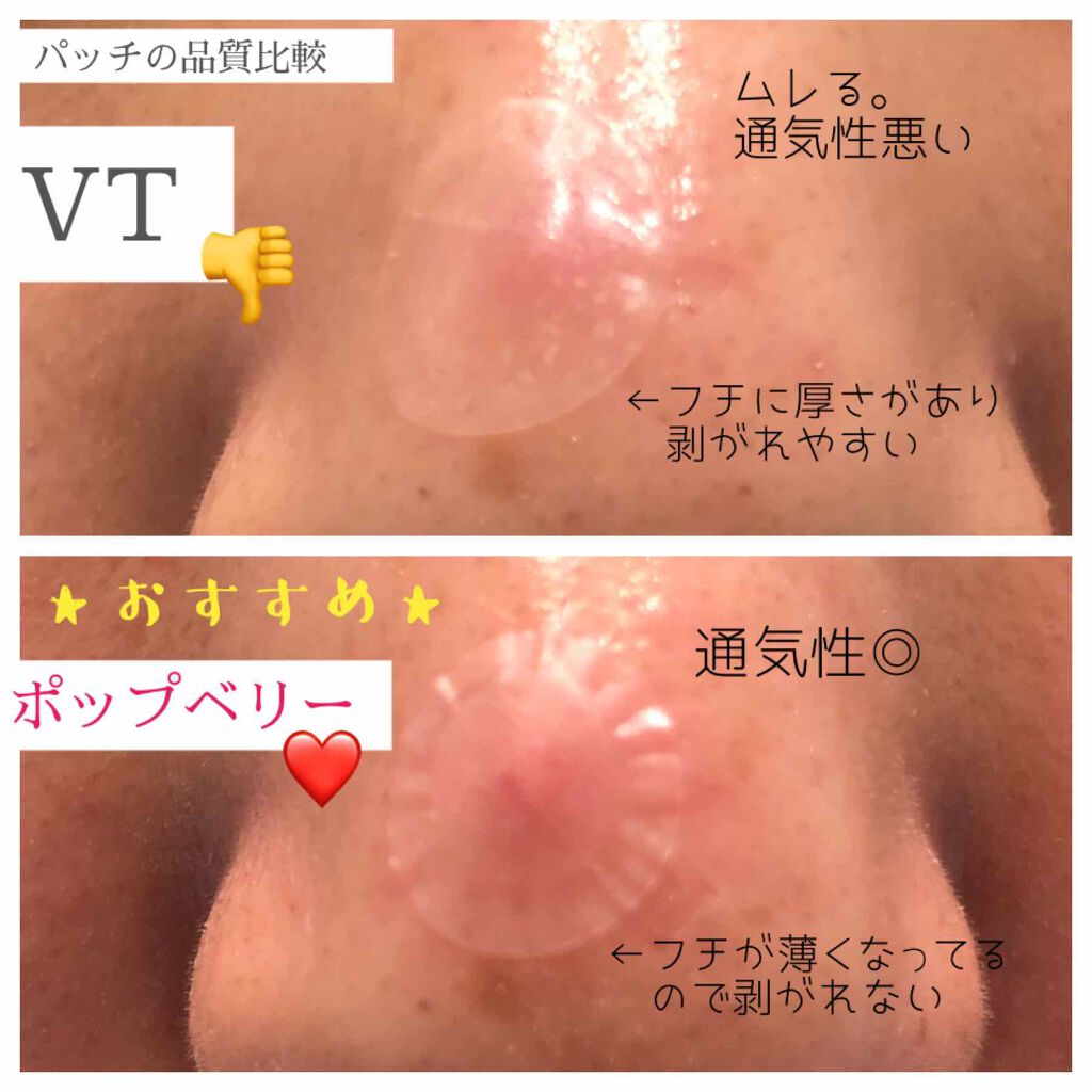 プロCICA クリアスポットパッチ/VT/その他スキンケアを使ったクチコミ(4枚目)