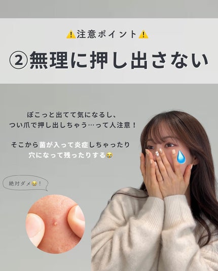 白湯(サユ) | ニキビと戦うOL🤍 on LIPS 「黄ニキビ一生繰り返してる😭😭って人集合!ありえないくらい目立..」(8枚目)