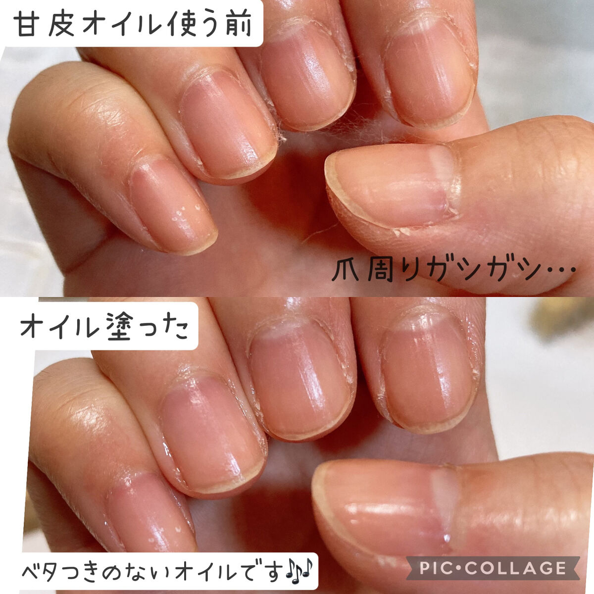 甘皮ケアオイル/無印良品/ネイルオイル・トリートメントを使ったクチコミ（3枚目）