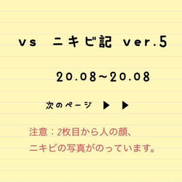 はとむぎエキス/DHC/健康サプリメントを使ったクチコミ（1枚目）