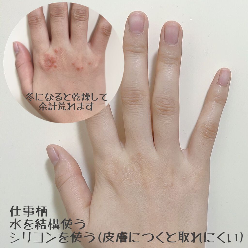 ビューティーチャージ 無香料/アトリックス/ハンドクリームを使ったクチコミ（2枚目）