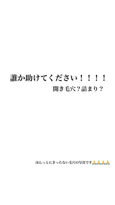 なこ on LIPS 「誰か助けてください！！！！！何年もずっとこの毛穴なんです🥲🥲🙃..」（1枚目）