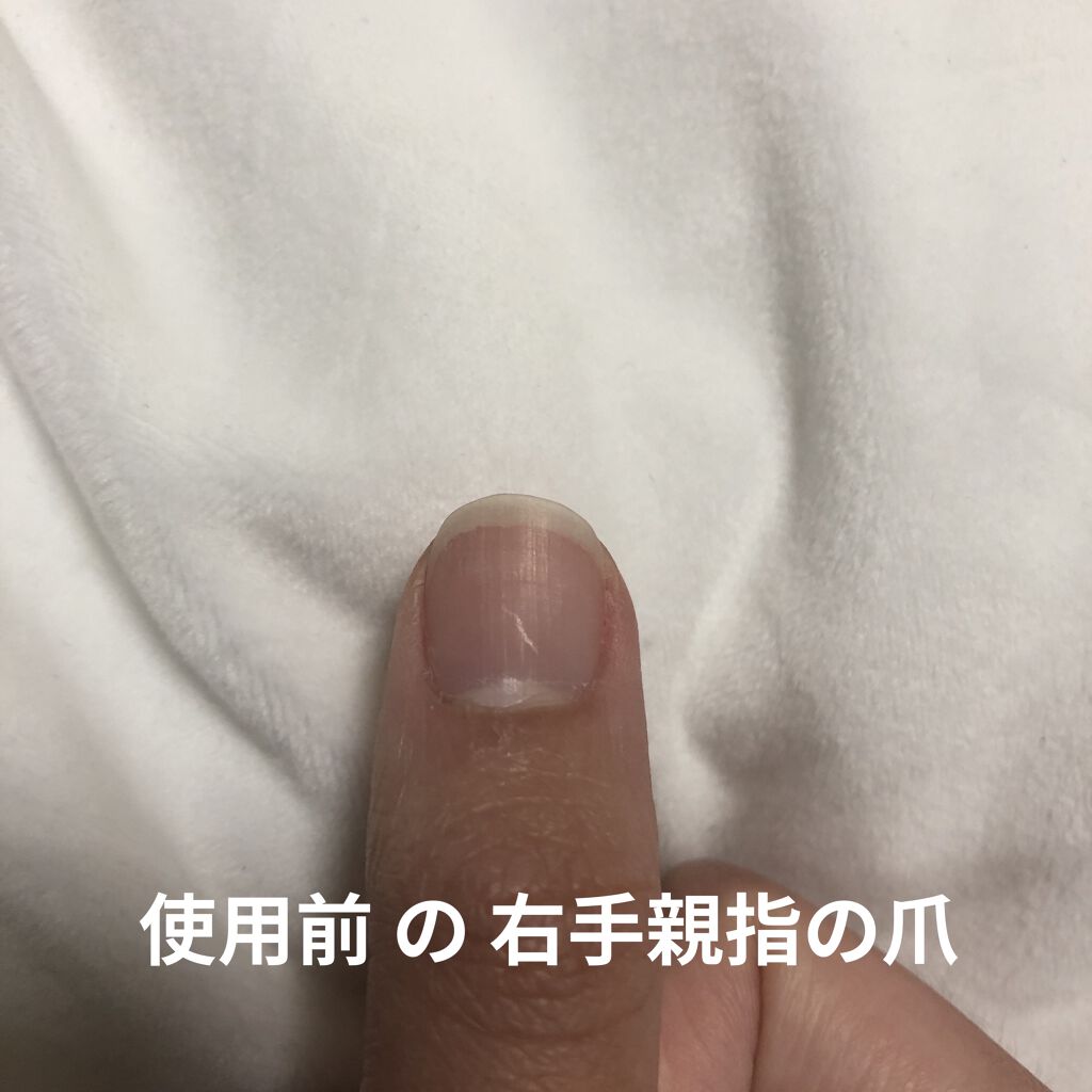 電動ネイルケア/DAISO/ネイル用品を使ったクチコミ（2枚目）