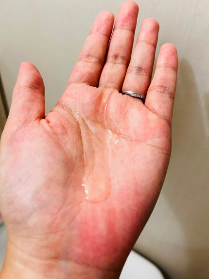 センテラ ライトクレンジングオイル/SKIN1004/オイルクレンジングを使ったクチコミ(2枚目)