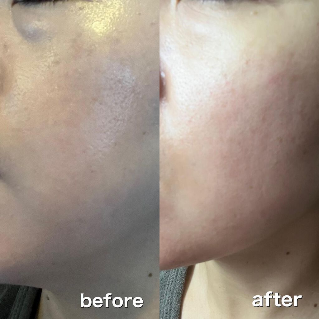 ジャイエライト ハイドラ ソリューション マスク/オアシス/シートマスク・パックを使ったクチコミ（3枚目）