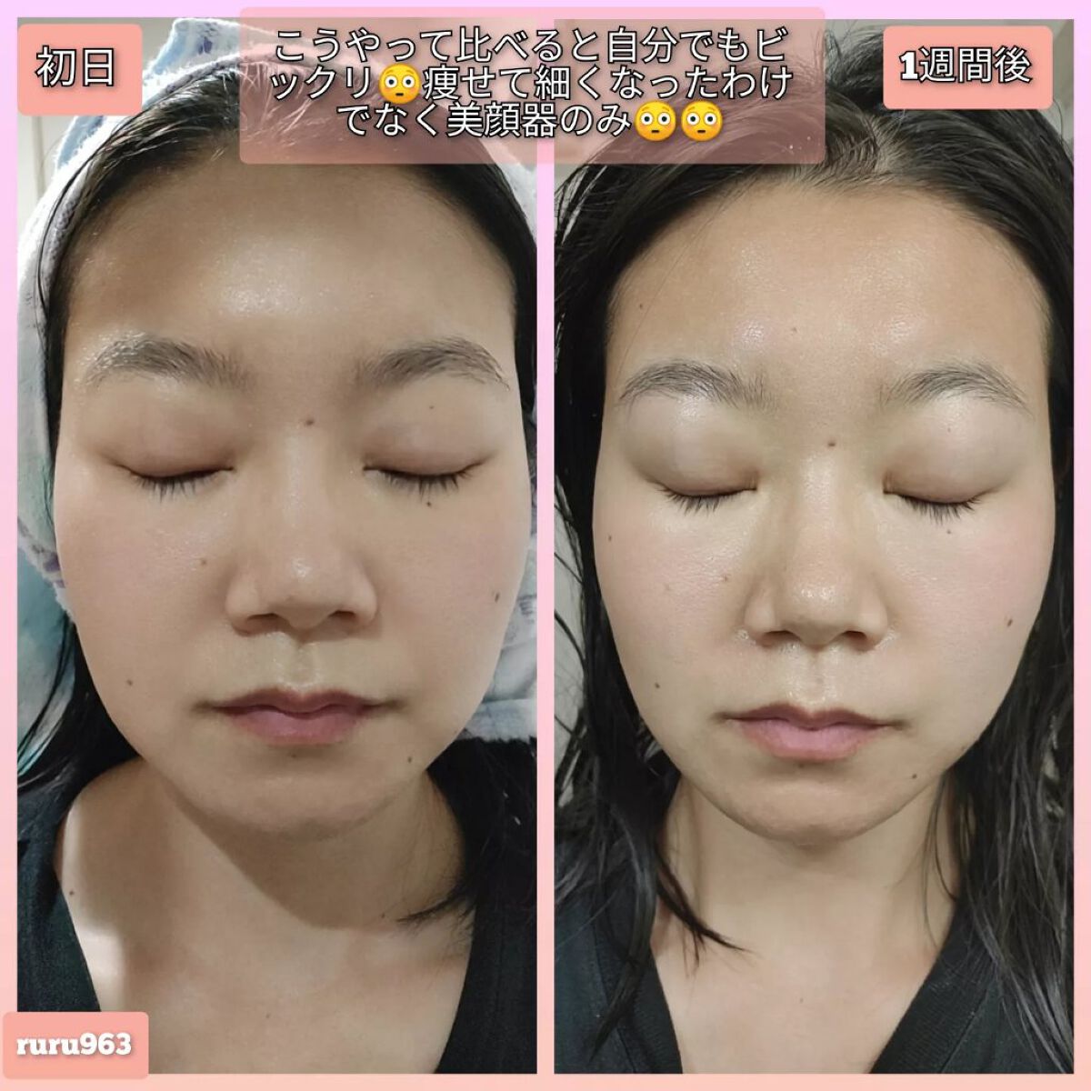 ELFACE/ELFACE/美顔器・マッサージを使ったクチコミ(7枚目)