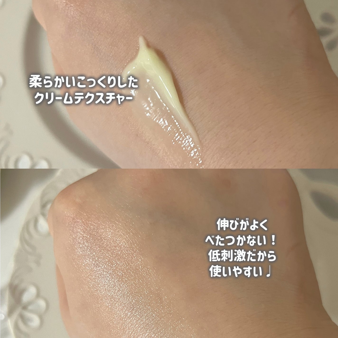 ヴィーガンリポソームレチノールセラム/SKIN&LAB/美容液を使ったクチコミ(3枚目)