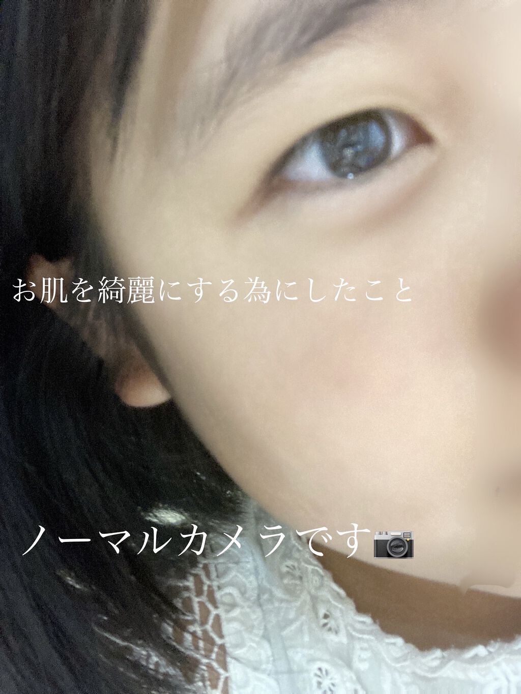 ヒルマイルドクリーム(医薬品)/健栄製薬/その他を使ったクチコミ（1枚目）