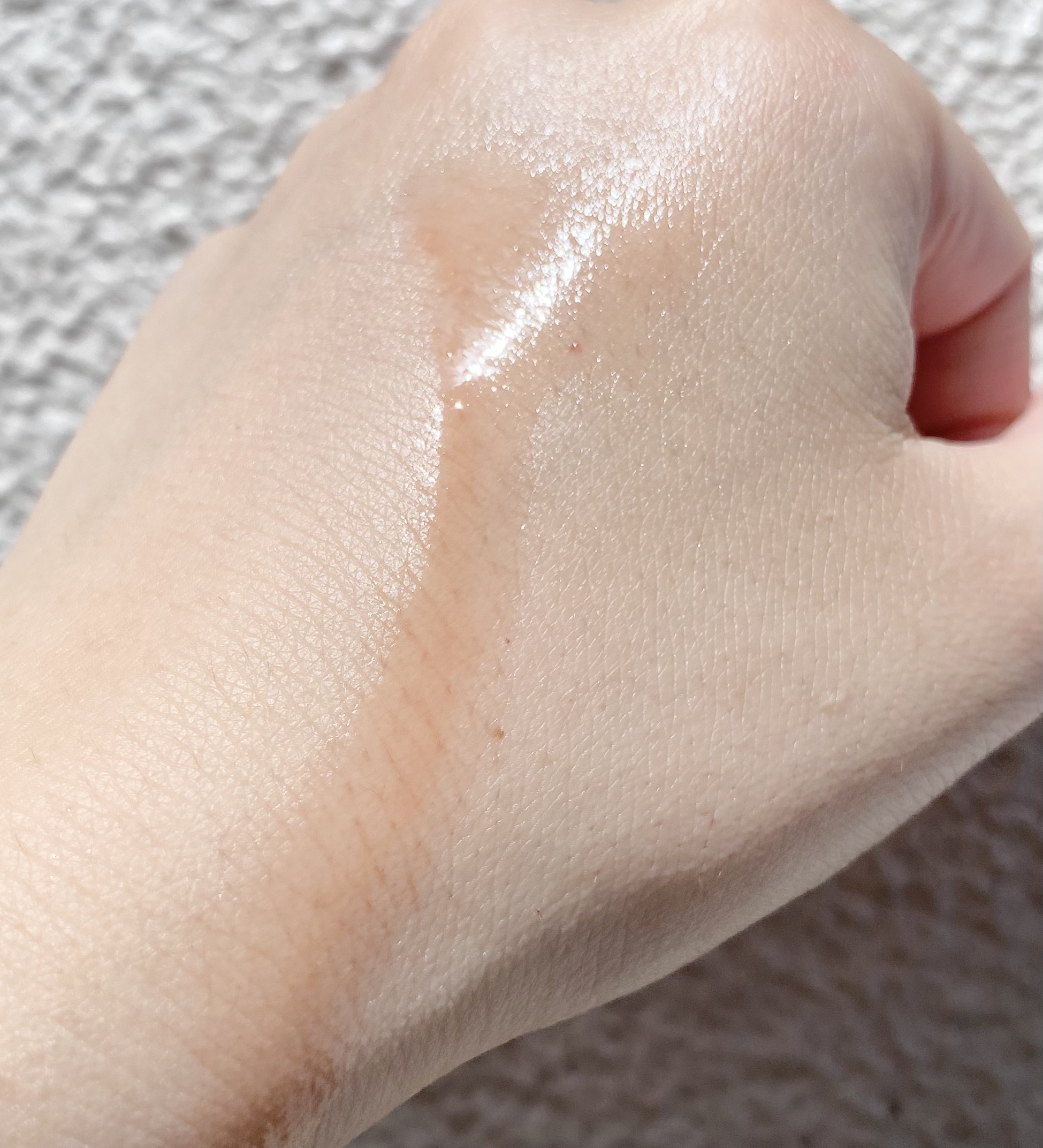 レッドアクネ ボディピーリングショット/MEDICUBE/ピーリングを使ったクチコミ（2枚目）