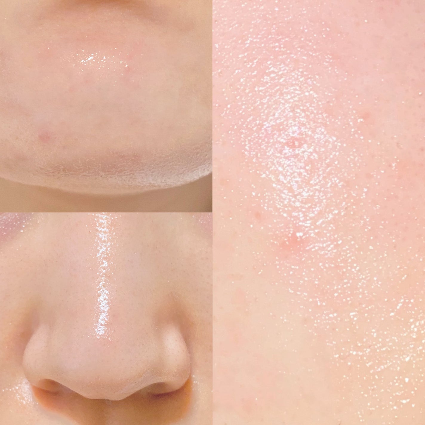 ビタペアC ビタレチ美容液/ネイチャーリパブリック/美容液を使ったクチコミ(4枚目)