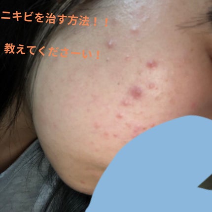 ティーツリーケアソリューション アンプルマスクJEX/MEDIHEAL/シートマスク・パックを使ったクチコミ(2枚目)