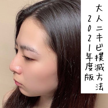 AHA 30% + BHA 2% Peeling Solution/The Ordinary/ピーリングを使ったクチコミ（1枚目）