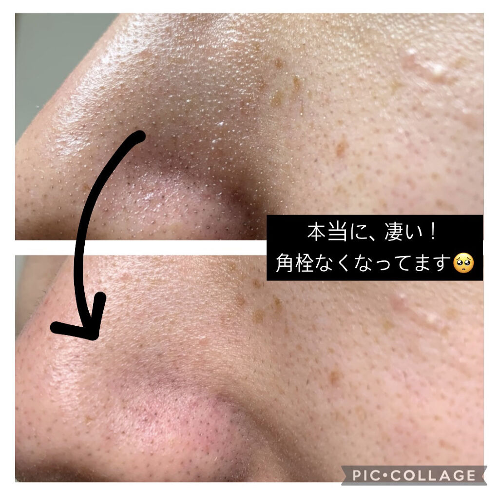 クレンジングバーム モイスト/CLAYGE/クレンジングバームを使ったクチコミ（2枚目）