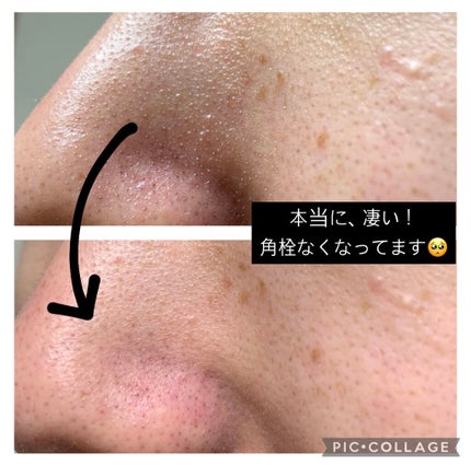 クレンジングバーム モイスト/CLAYGE/クレンジングバームを使ったクチコミ(2枚目)