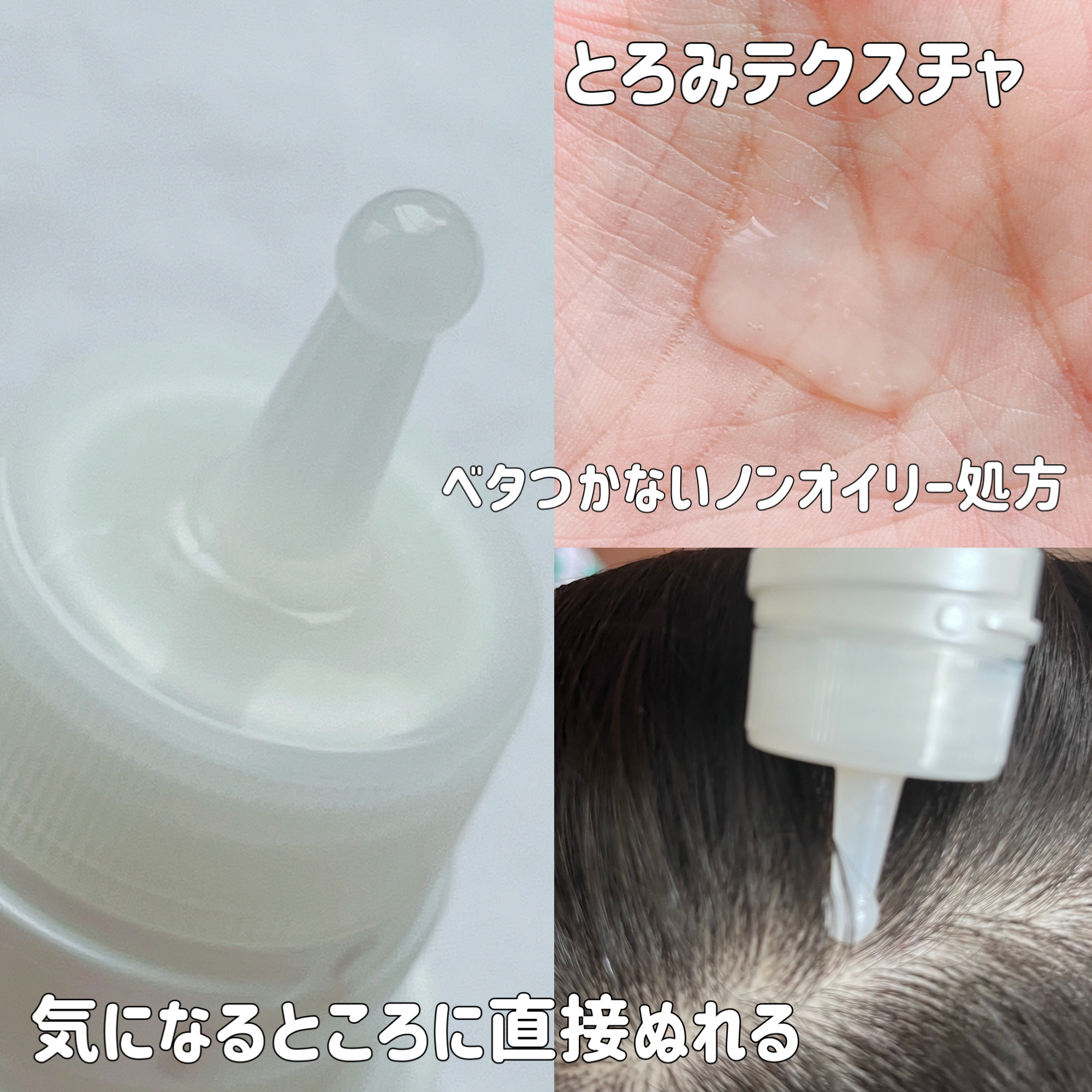 頭皮保湿ローション/キュレル/頭皮ローションを使ったクチコミ（3枚目）