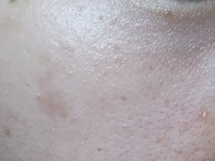 スキントリートメント ファンデーション/ナチュラグラッセ/リキッドファンデーションを使ったクチコミ(2枚目)