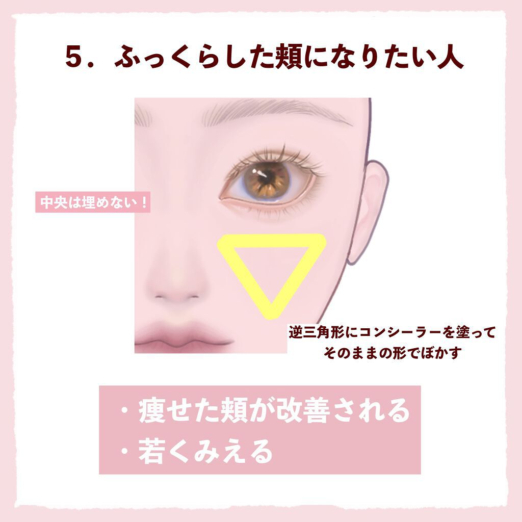 ラディアントクリーミーコンシーラー/NARS/リキッドコンシーラーを使ったクチコミ(6枚目)