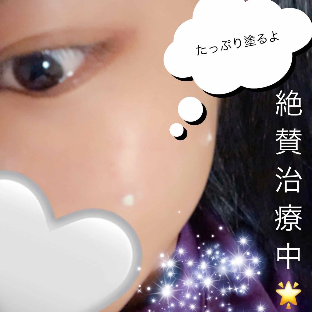 ニキビ治療薬(医薬品)/メンソレータム アクネス/その他を使ったクチコミ(3枚目)