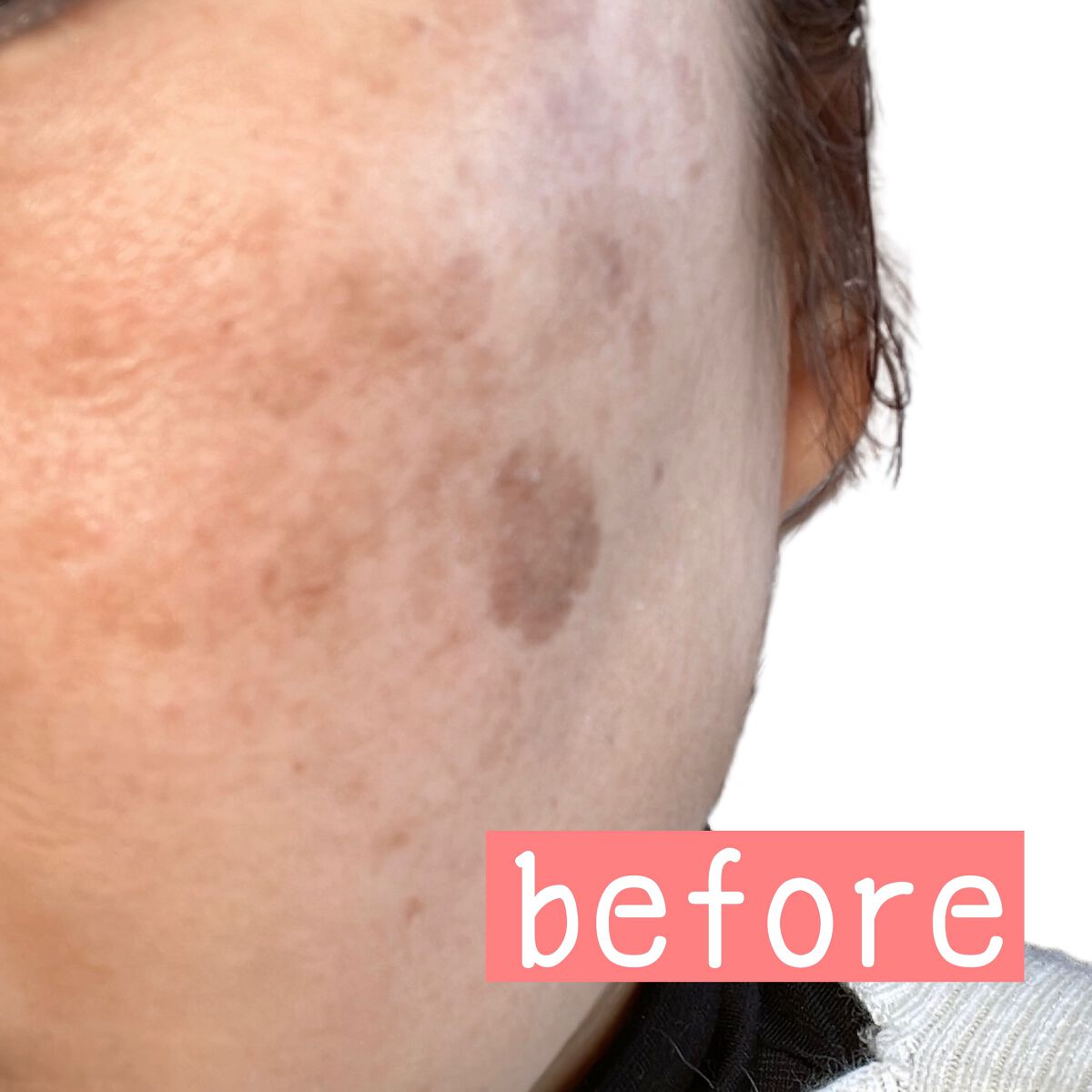 コンシーラー/ちふれ/リキッドコンシーラーを使ったクチコミ(3枚目)