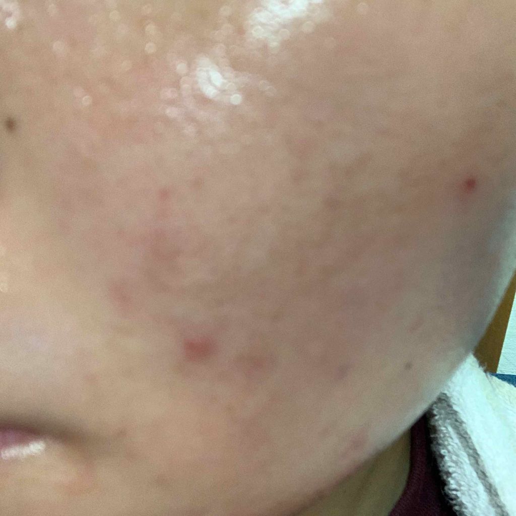 ドクタージャルト シカペア クリーム （第2世代）/Dr.Jart＋/フェイスクリームを使ったクチコミ（1枚目）