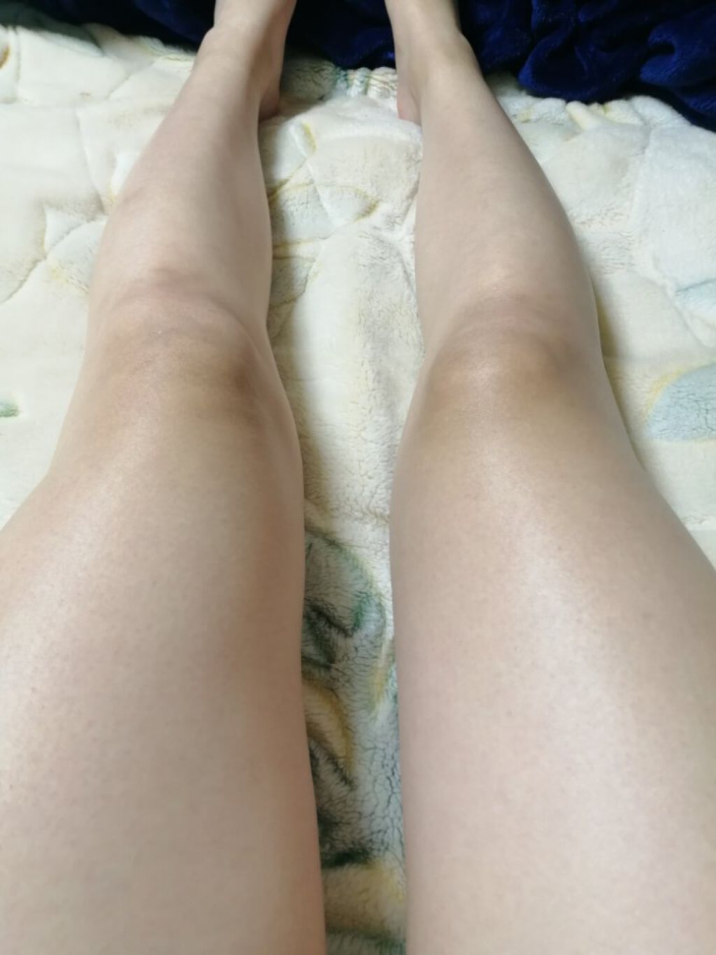 スキンミルク(しっとり)/ニベア/ボディミルクを使ったクチコミ（2枚目）