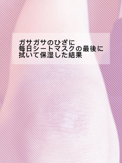 マイクワゾウスキ【フォロバ100%】 on LIPS 「おはようございます。汚い写真ですみません。私、油断すると片膝だ..」(1枚目)