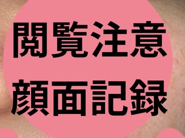 ビビ on LIPS 「顔面記録3日目遅くの投稿になってしまった…就寝1月7日深夜０時..」（1枚目）