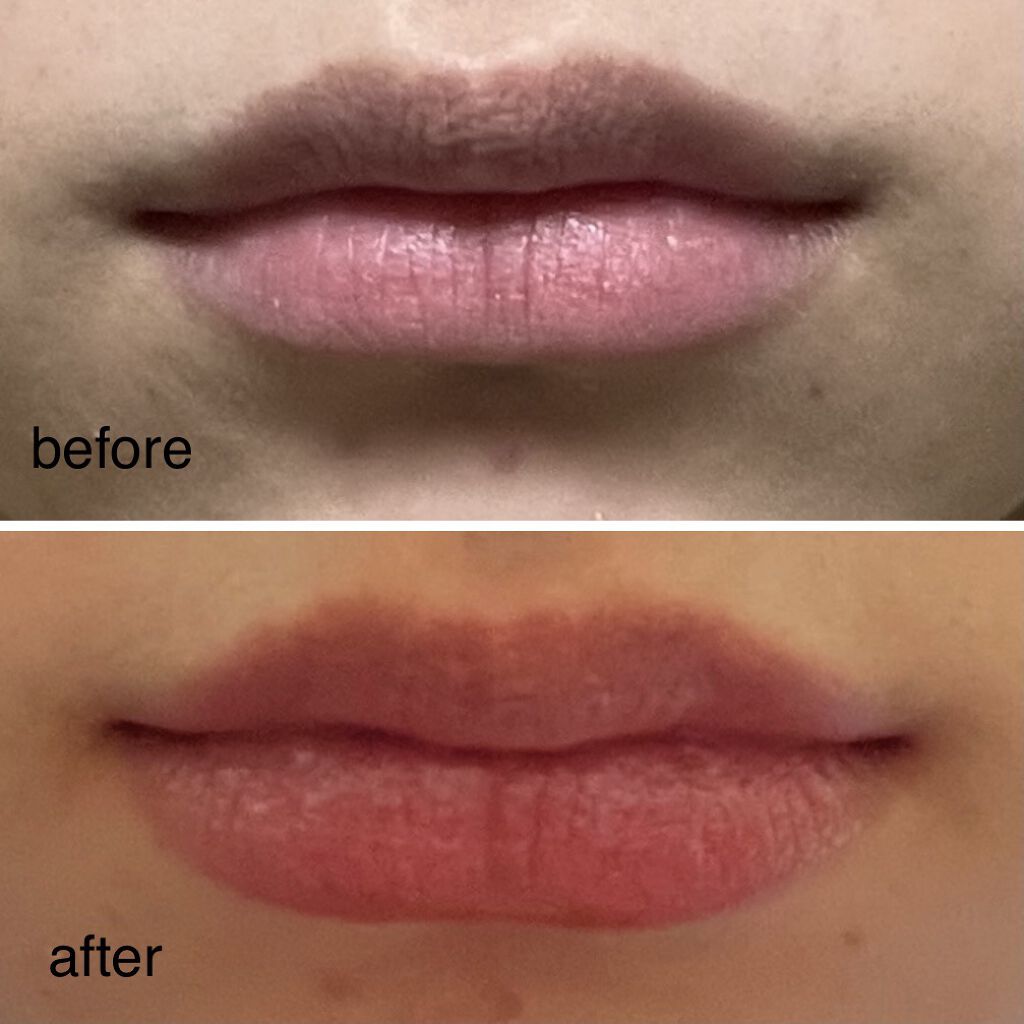 リップトリートメントバーム/LANEIGE/リップケアを使ったクチコミ（2枚目）