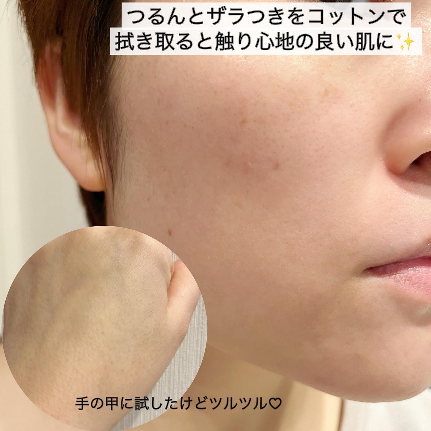 ホームピールコンセントレート/HERBAL PEEL/化粧水を使ったクチコミ（3枚目）