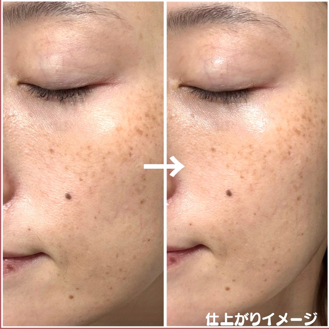 ざくろ ファーミングローション EX/WELEDA/化粧水を使ったクチコミ（3枚目）