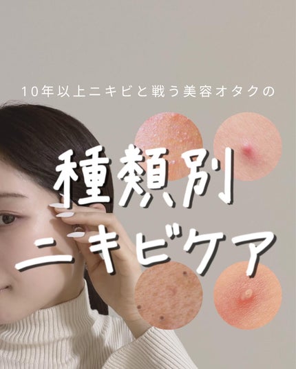 ニキビ治療薬(医薬品)/メンソレータム アクネス/その他を使ったクチコミ(1枚目)