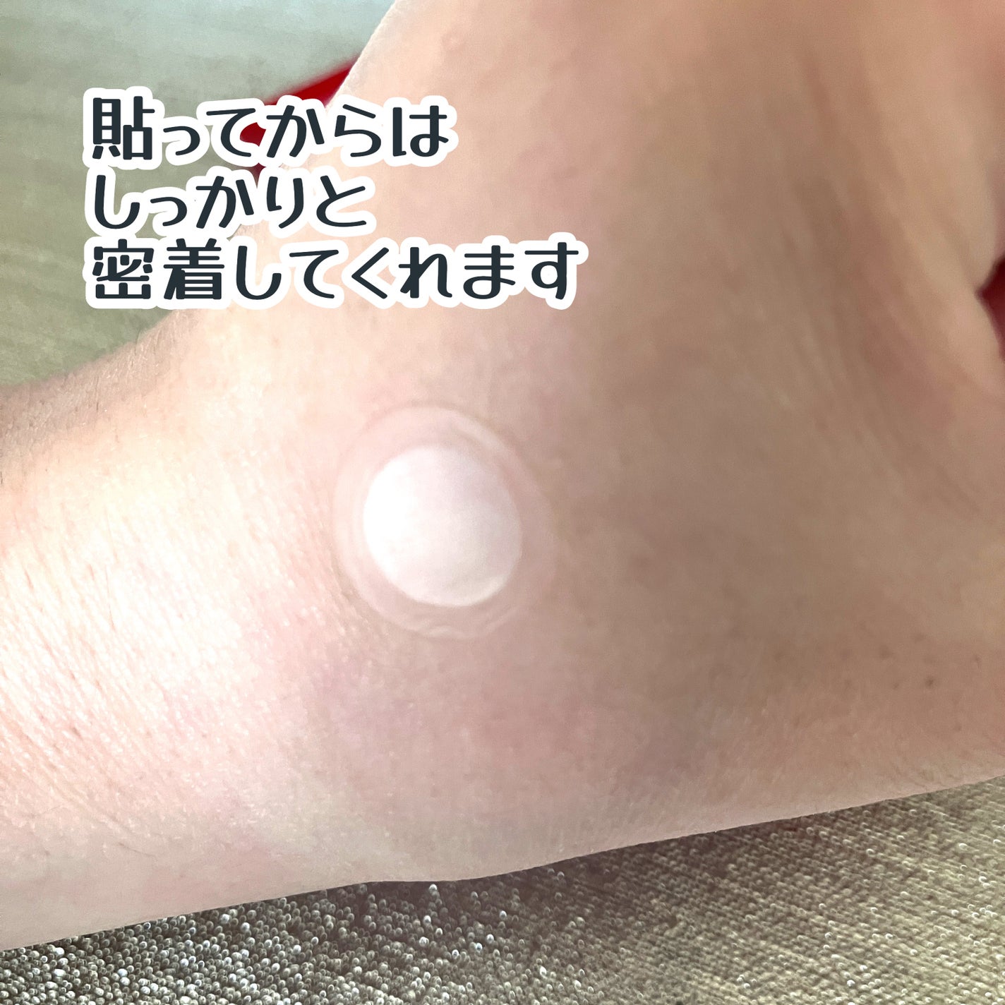 エーキュアショットスポットパッチ/obsero/にきびパッチを使ったクチコミ(6枚目)