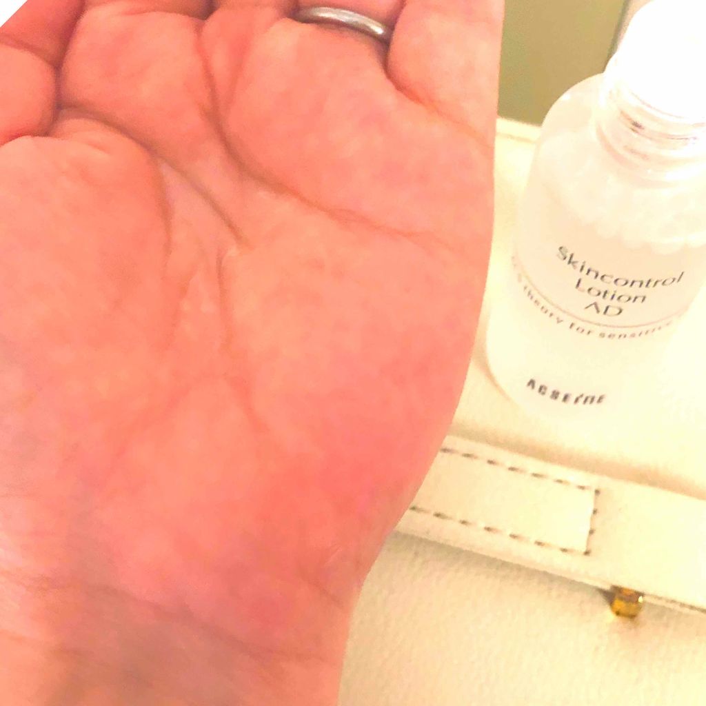 スキンケアプログラム AD/ACSEINE/トライアルキットを使ったクチコミ(2枚目)