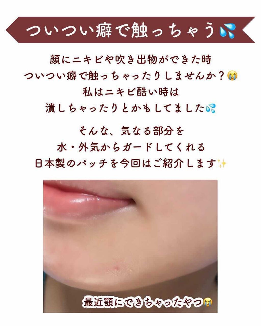 Today’s Cosme ゼロスポットパッチのクチコミ「【ニキビの上からメイクもできちゃう優秀パッチ✨】
.
顔にニキビや吹き出物ができた時
ついつい.....」（2枚目）