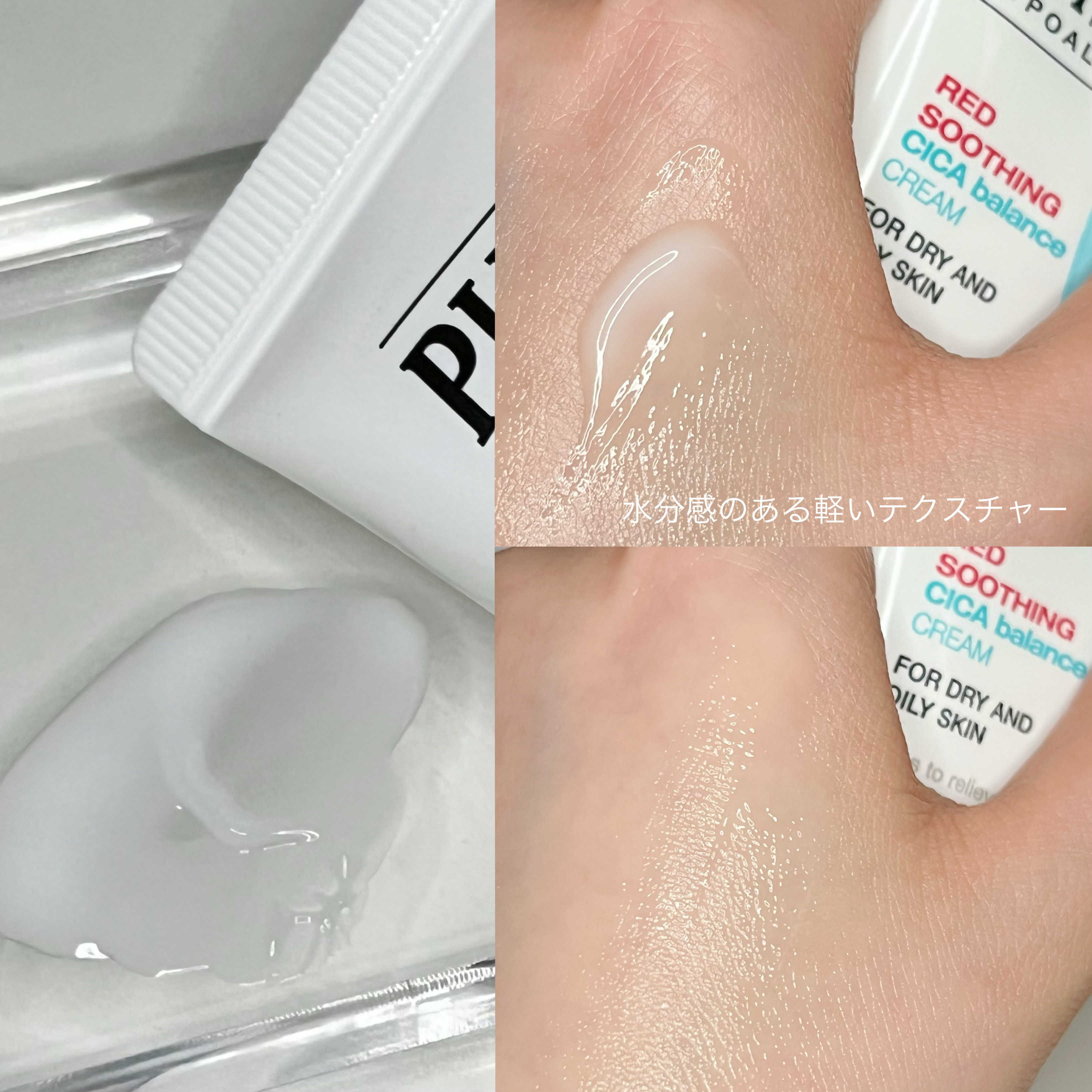 アクネケア クリアリング フェイシャル クリーム/PHYSIOGEL/フェイスクリームを使ったクチコミ（2枚目）