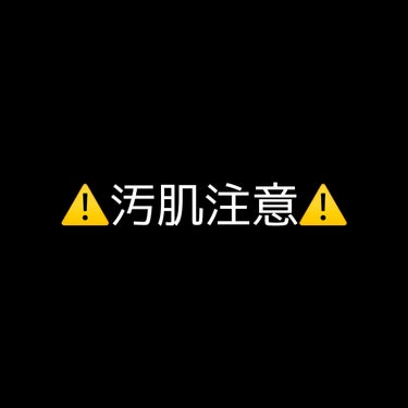 あんにょん✌️

いきなりですが私はすごーーーく、汚い肌が悩みでした…

私は乾燥肌で敏感肌です

原因として(多分)
。ストレス
。水が合わなかった
。保湿なし
。化粧用具の汚れ
。ニキビの気にし過ぎ