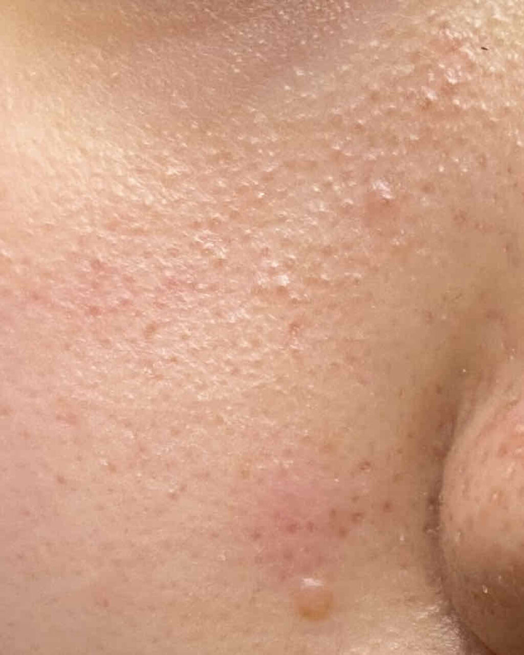 濃密うるみ肌 オールインワンリッチジェル/DHC/オールインワン化粧品を使ったクチコミ（3枚目）