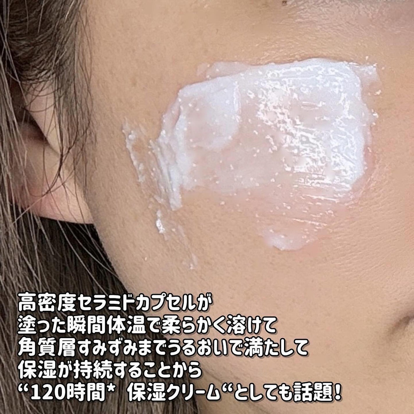 アトバリア365クリーム/AESTURA/フェイスクリームを使ったクチコミ(4枚目)