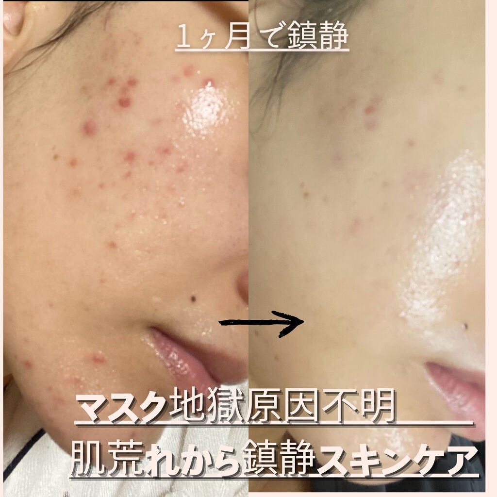 ベータ クレンジングパウダー/ディーアールイシイスペシャル/洗顔パウダーを使ったクチコミ(1枚目)