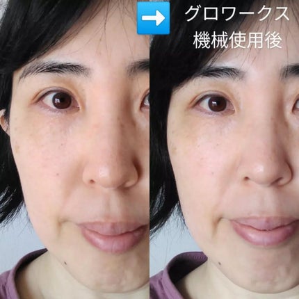 4Dモーションスキンブースタ/gloworks/美顔器・マッサージを使ったクチコミ(3枚目)