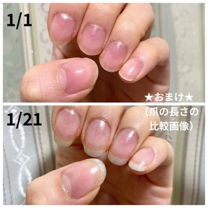 エテュセ クイックケアコート/ettusais/ネイルオイル・トリートメントを使ったクチコミ(8枚目)