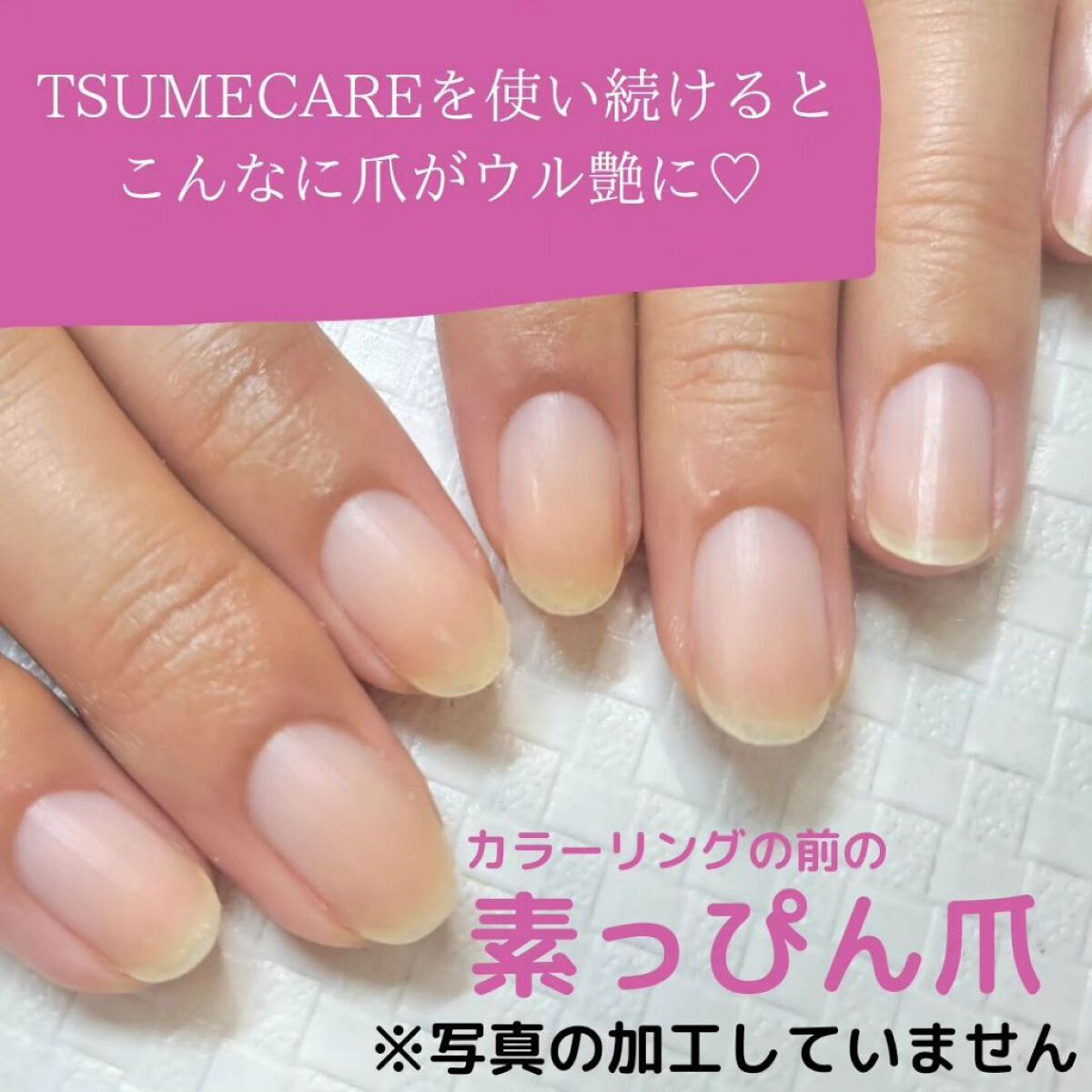 TSUMECARE/NailSalon mayunail/ネイルオイル・トリートメントを使ったクチコミ（1枚目）