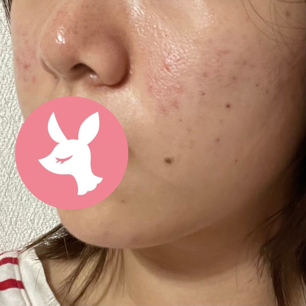 たべっこ on LIPS 「8/30(月)☀️夜ビタミンCパック30枚入、5枚のやつと同じ..」(2枚目)