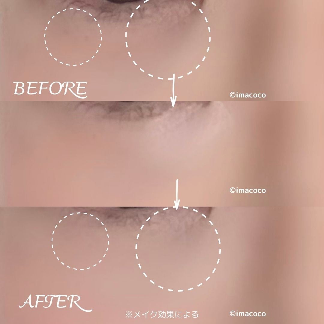 ダブルラスティング コンシーラーパレット/ETUDE/パレットコンシーラーを使ったクチコミ(7枚目)