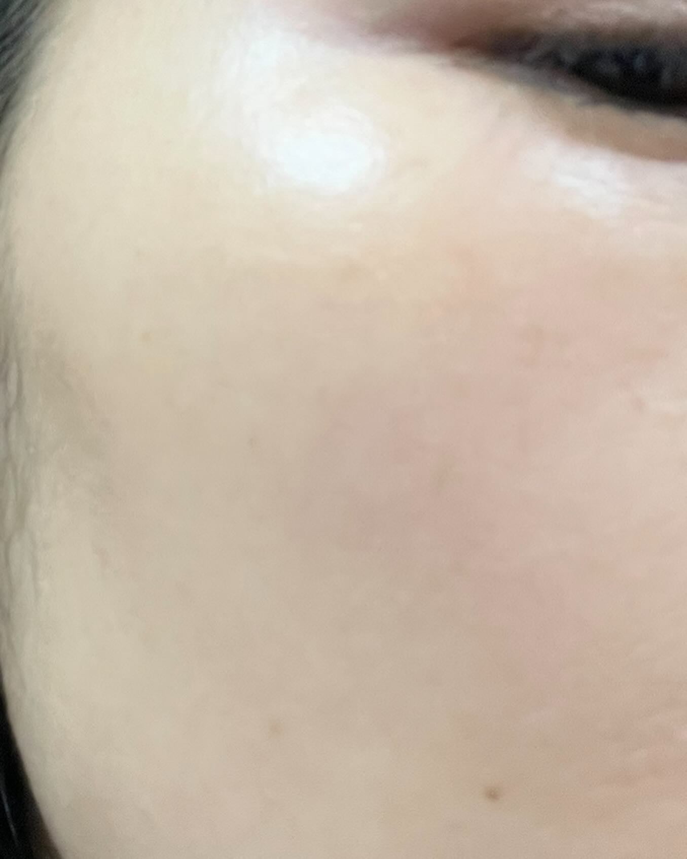 シャンティ on LIPS 「\星のように輝く艶肌/\遂に日本上陸/------------..」(5枚目)