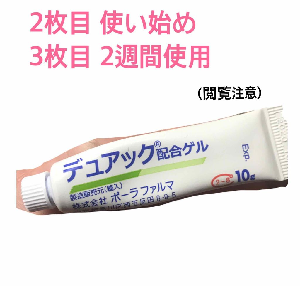 ハンガー on LIPS 「芯みたいなのは無くなったけど塗った瞬間からかゆみ!!2週間使っ..」(1枚目)